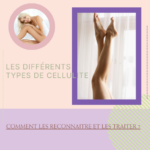 Cet article présente les types de cellulite (aqueuse, graisseuse, fibreuse), leurs caractéristiques et leurs causes. Il propose des conseils pratiques pour les traiter, incluant l'hydratation, l'alimentation, l'exercice et l'utilisation de produits de soin comme la crème anti-cellulite et le gommage de la marque Thalasso Bretagne, disponibles sur la boutique en ligne "Les Petites Bulles de Madeline".